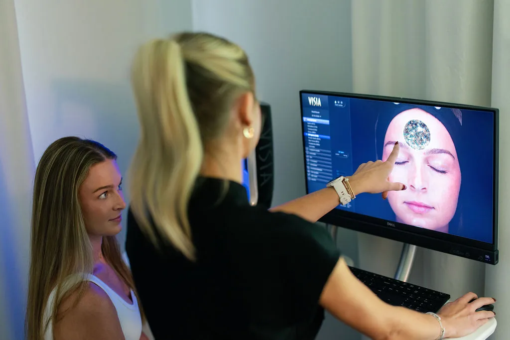 visia skin analysis 09
